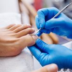 Remedios caseros para combatir y sanar el hongo en las uñas.