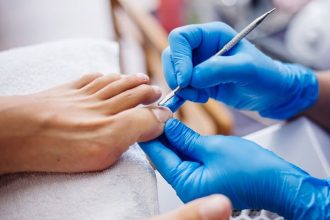 Remedios caseros para combatir y sanar el hongo en las uñas.